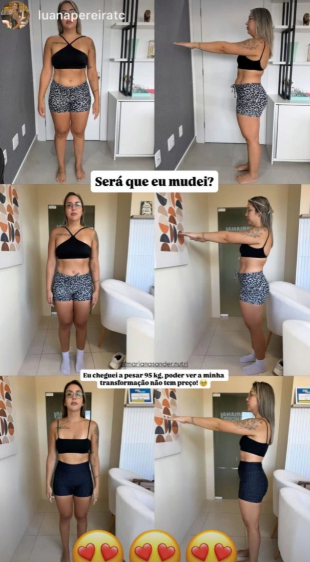 Comparação de registros de evolução corporal em três momentos.