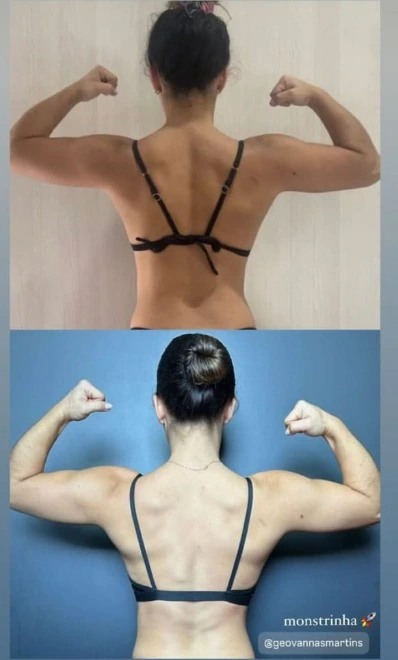Comparação de registros de costas com braços flexionados.